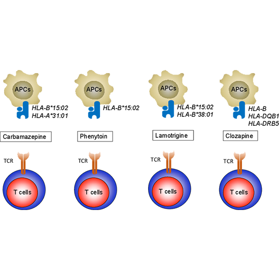 Hypersensitivity to Carbamazepine